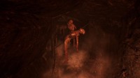 Agony
